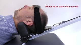 Neck Decompression Machine  Cervical Mechanical Traction [upl. by Aneehsak]