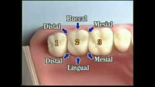 V109 Patient Records Management amp Dental Charting [upl. by Seuguh]