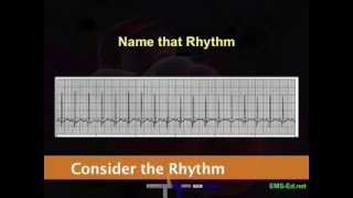 Intro EKG Interpretation Part 2 [upl. by Zenger265]