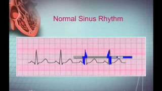 Intro EKG Interpretation Part 1 [upl. by Reppiks]