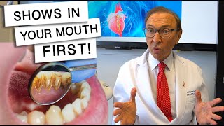 5 Diseases That Show Signs In Your Mouth [upl. by Rosemary]