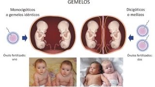 Las 4 señales TEMPRANAS de que estás embarazada de GEMELOS [upl. by Emse275]