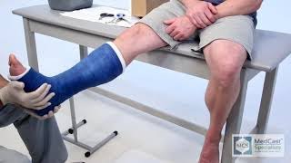 Short Leg Cast  Easy  With Cast Removal [upl. by Oirom]