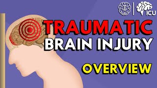 Overview of Traumatic Brain Injury TBI [upl. by Cole]