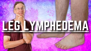 DIY  How to wrap your Lymphedema leg using compression bandages [upl. by Pytlik]