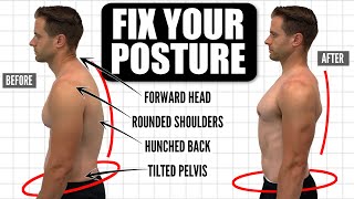 How To FIX Your Posture  10Minute Daily Routine [upl. by Nanyt963]