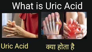 Uric Acid क्या होता है What is uric acid [upl. by Demetria]