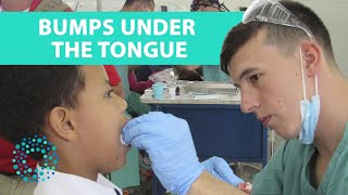 BUMPS UNDER THE TONGUE Symptoms amp Causes [upl. by Aveline]