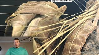 Brachial Plexus EXPLAINED Using a Cadaver [upl. by Onitsuaf]