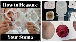 How to Measure Your Stoma OSTOMY TIPS [upl. by Hiram]