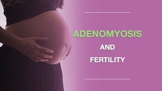 Adenomyosis Symptoms Why Adenomyosis Is Often Misdiagnosed And What to Do About It [upl. by Safier500]