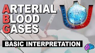 Basic ABG Interpretation  Arterial Blood Gases Part 3 [upl. by Lenni]