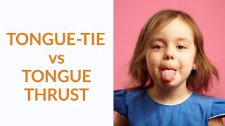 TongueTie vs Tongue Thrust  Whats The Difference [upl. by Vasilis856]