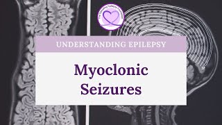 What are Myoclonic Seizures [upl. by Amelie]