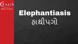 Elephantiasis  હાથીપગો  Human Health and Diseases  11th science biology [upl. by Selrahcnhoj921]