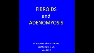 FIBROIDS AND ADENOMYOSIS [upl. by Artina]