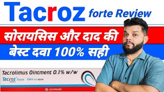 Tacroz Forte Ointment Review  Tacrolimus Ointment Uses Mode Of Action amp Side Effects In Hindi [upl. by Messere]