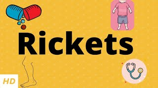 Rickets Causes Signs and Symptoms Diagnosis and Treatment [upl. by Ahtabat]