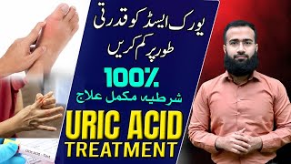 Uric Acid Treatment  Natural Remedies for GOUT Get Rid of Hyperuricemia [upl. by Haizek]