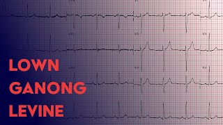 Lown Ganong Levine  ECG EKG Interpretation [upl. by Boni437]