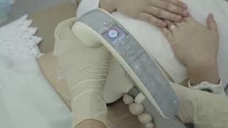 Velashape III – Latest technology for body reshaping [upl. by Eilyah326]