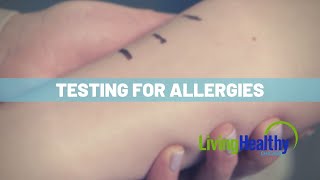 How Allergy Testing Works [upl. by Oicaro379]