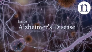 Inside Alzheimer’s disease [upl. by Selohcin155]