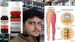 homeopathic medicine for treatment of sciatica explain [upl. by Fennie]