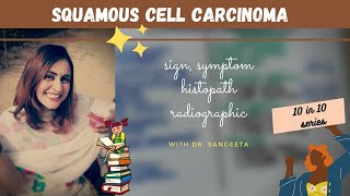 Introduction to Skin Cancer 3 Overview of Nevi and Melanoma [upl. by Laws]